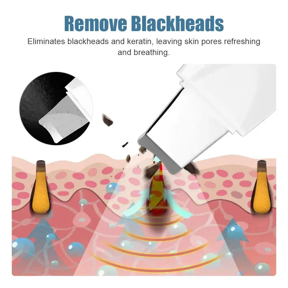 Blackhead Remover - Image 5