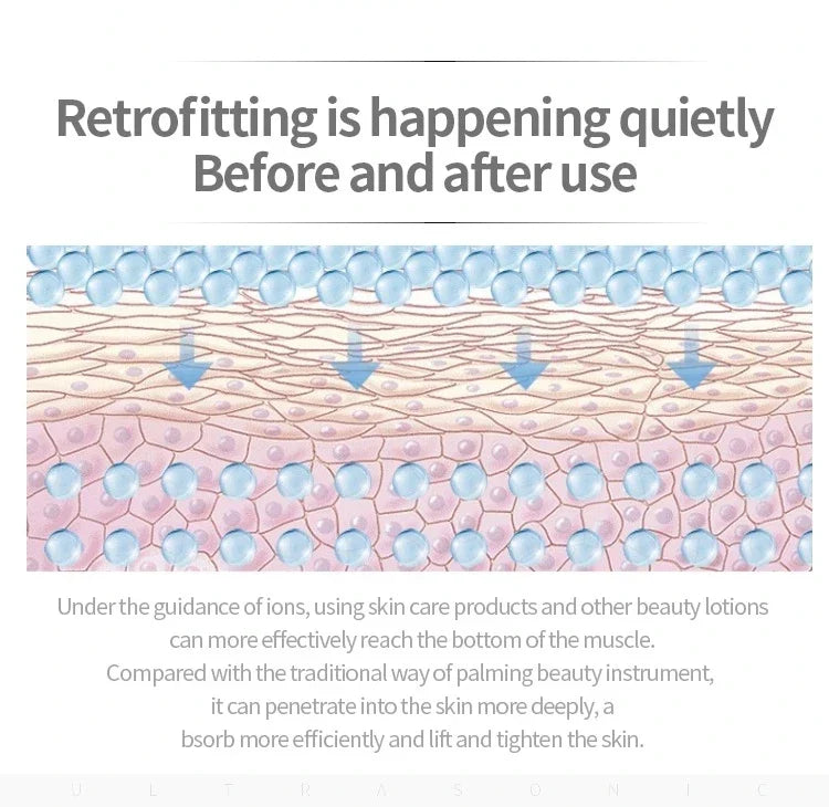Blackhead Remover - Image 16